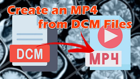 How to Convert DICOM Images (.DCM) to an MP4 Video?