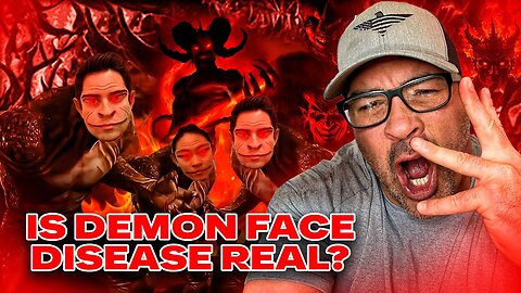 David Rodriguez Update Today Apr 7: "Demon Face Syndrome Revealed..Shapeshifters Among Us?"