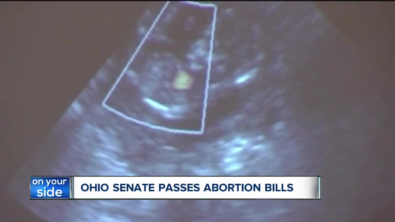 Ohio Senate passes two abortion-related bills