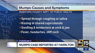 Mumps case confirmed at Hamilton High School