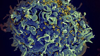 Researchers Say A 2nd Person Has Been Cured Of HIV