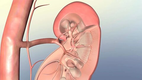 Understanding Kidney Failure