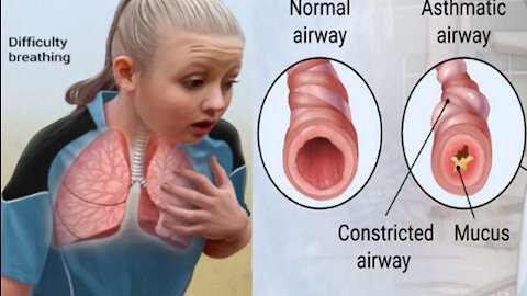 Asthma Charity Suffocates Patients on Govt Orders