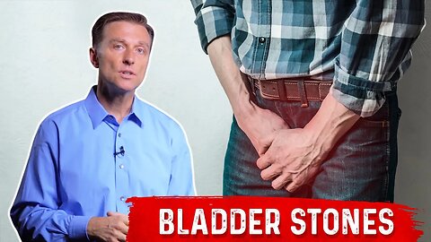 Bladder Stones: Causes, Symptoms & Remedies | Dr. Berg