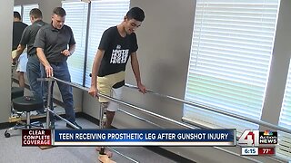 Teen gunshot victim receives prosthetic leg