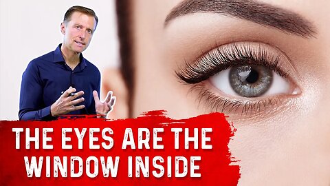 Eye Health – 11 Things Your Eyes Tell You About the Nutrients In Your Body – Dr.Berg
