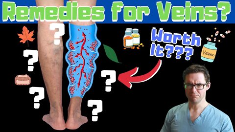 #1 Best Varicose Vein Home Remedies [Spider Veins in Legs Treatment]