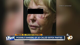 Possible dangers of botox parties