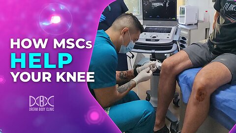 How Mesenchymal Stem Cell help your Knee
