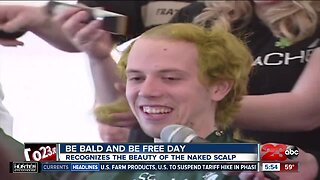 Be Bald and Be Free Day