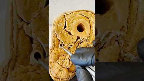 Inside a Real Human Thigh