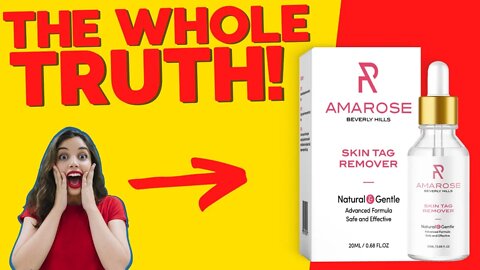 Amarose Skin Tag Remover Review | Amarose Skin Tag Remover Work? Amarose Skin Tag Side Effects