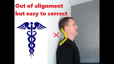 Neck tension? Back problems? Poor upper body posture? Correct this condition now - Hyper Kyphosis