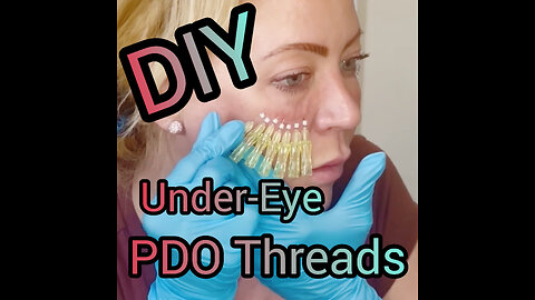 DIY Under-Eye PDO Threads, Beginners #diy #threads #ourbodyourright #antiaging