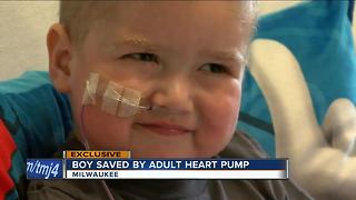 Experimental procedure saves 4-year-old’s heart