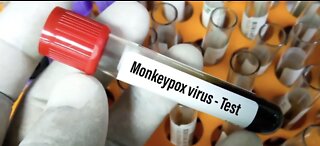 Southern Nevada Health District creates Monkeypox dashboard