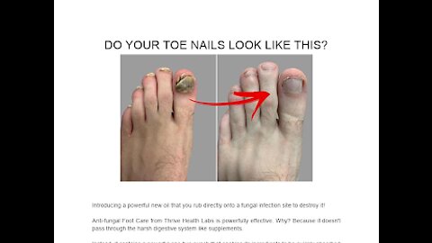Anti Fungal Foot Care Serum Anti-Fungal Foot Care oil, used to treat nail fungus😱😱😱