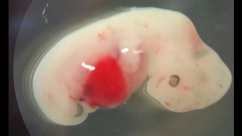 Scientists created the first human-pig embryo that could revolutionize healthcare