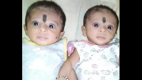 10 instances of twins harmed by vaccination