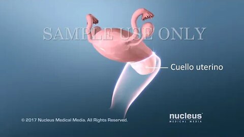 Pruebas de Papanicolaou y VPH