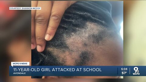 Mom pulls 11-year-old girl out of school after boy rips her hair out