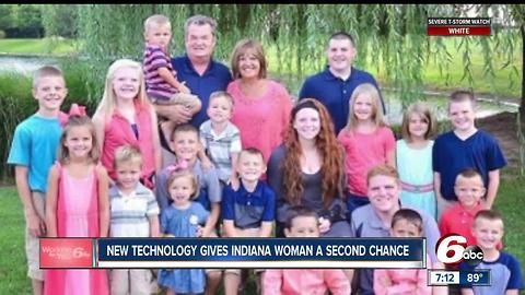 New Technology gives Indiana woman second chance