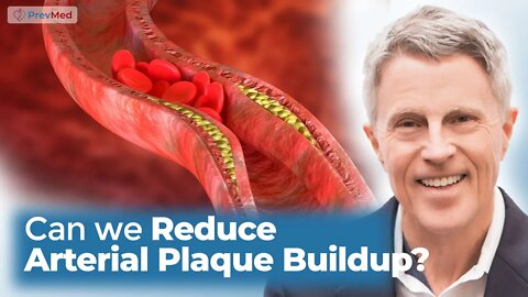 Can We Reduce Arterial Plaque Buildup?