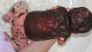 Majka je bila šokirana kad je vidjela da je beba prekrivena crnim, krvavim mrljama