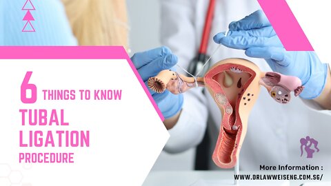 6 Things to Know About Tubal Ligation Procedure