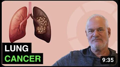 Lung Cancer - How to Treat Naturally in 2021