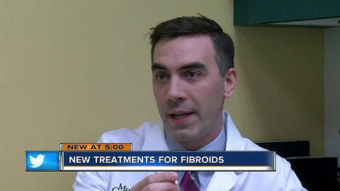 Froedert doctors research less invasive ways to solve fibroids, benign tumors in women