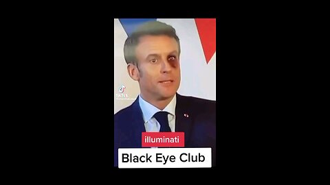Is there a such thing as 'Black Eye Club' in the Elite
