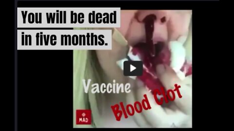 Steve Kirsch: The Vaxxed Are Dying After 5 Months and Another Young (Doubled Jabbed) Nurse Drowns