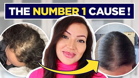 The Number 1 Cause of Hair Loss in WOMEN (+ how to beat it and tips to grow your hair)
