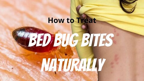How to Treat Bed Bug Bites | 12 Steps to Treat Bed Bug Bites - Daily Needs Studio