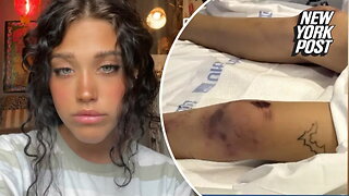 College student Isabella Willingham suffers ghastly injuries while unconscious for 23 minutes in dorm room — and no one knows what happened