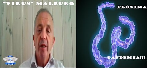"Virus" de Marburg: ¿Próxima Pandemia????