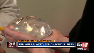 Increasing number of women removing breast implants due to chronic illness