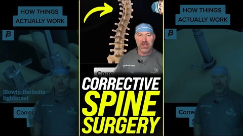 Corrective Spine Surgery 😱 #shorts