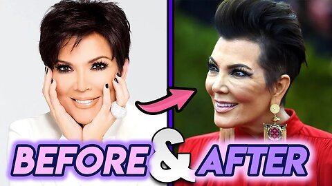 Kris Jenner | Before and After Transformations | Plastic Surgery Rumours