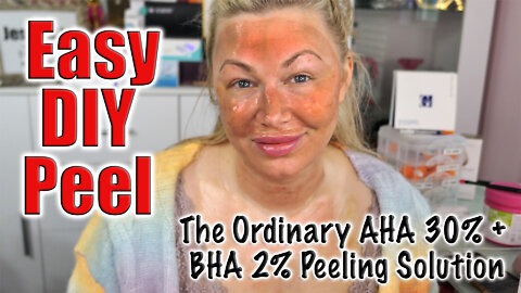 EASY DIY Peel - The Ordinary AHA 30% + BHA 2% Peeling Solution