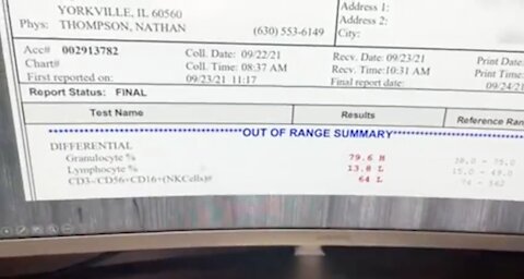 My Jaw Dropped When I Tested Someone's Immune System After the 2nd Jab