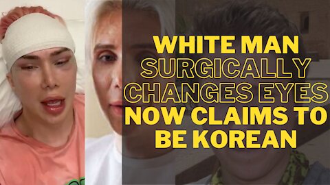 White Man Claims to Be TransRacial and Gets Eyes Surgically Changed and Now Calls Himself Korean