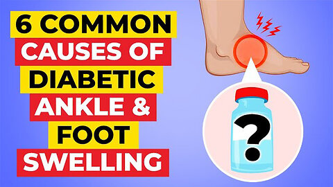 The 6 Most Common Causes Of Foot & Ankle Swelling + 6 Amazing Remedies To Fix It!