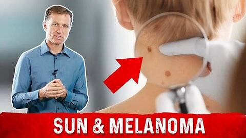 Does the Sun Cause or Prevent Melanomas?