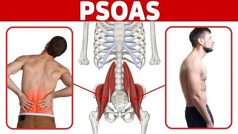 The BEST Way to Release a Tight Psoas Muscle for Low Back Pain and Poor Posture
