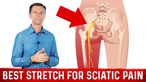 Best Stretches for Sciatica Nerve Pain Relief – Dr. Berg