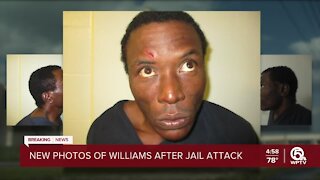 New photos show injuries to Semmie Williams Jr. after jail incident