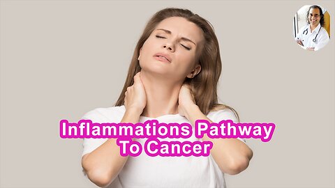 Inflammation Is A Pathway To Cancer Over Time