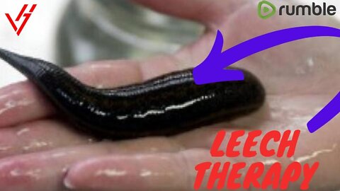 Leech therapy